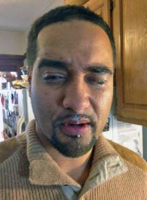 Jesse Hagopian after being pepper sprayed